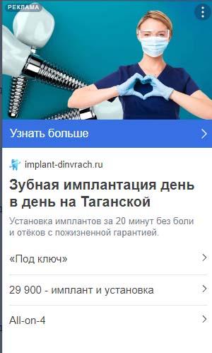 Объявление РСЯ под домен по имплантации: имплантация день в день на Таганской